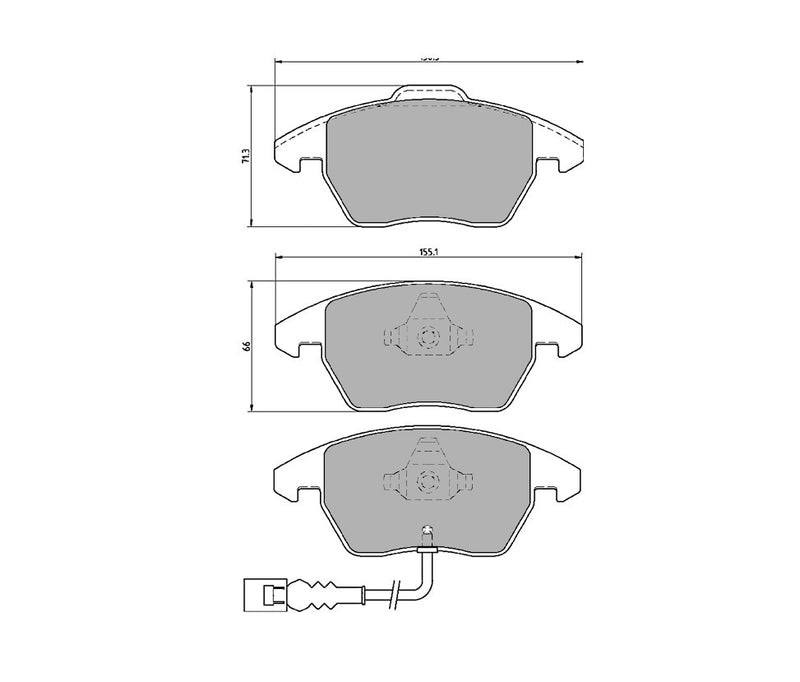 Pastillas de freno delanteras Pro Race (PBS Brakes)